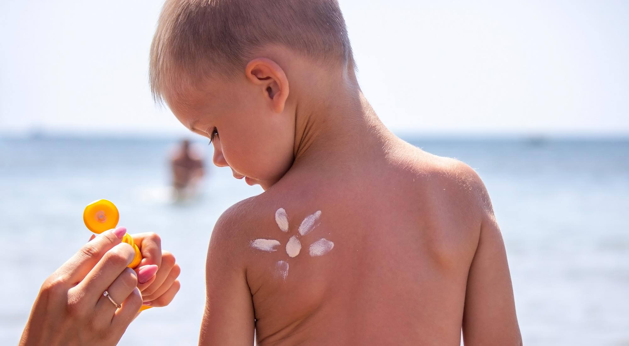 sun allergy in children