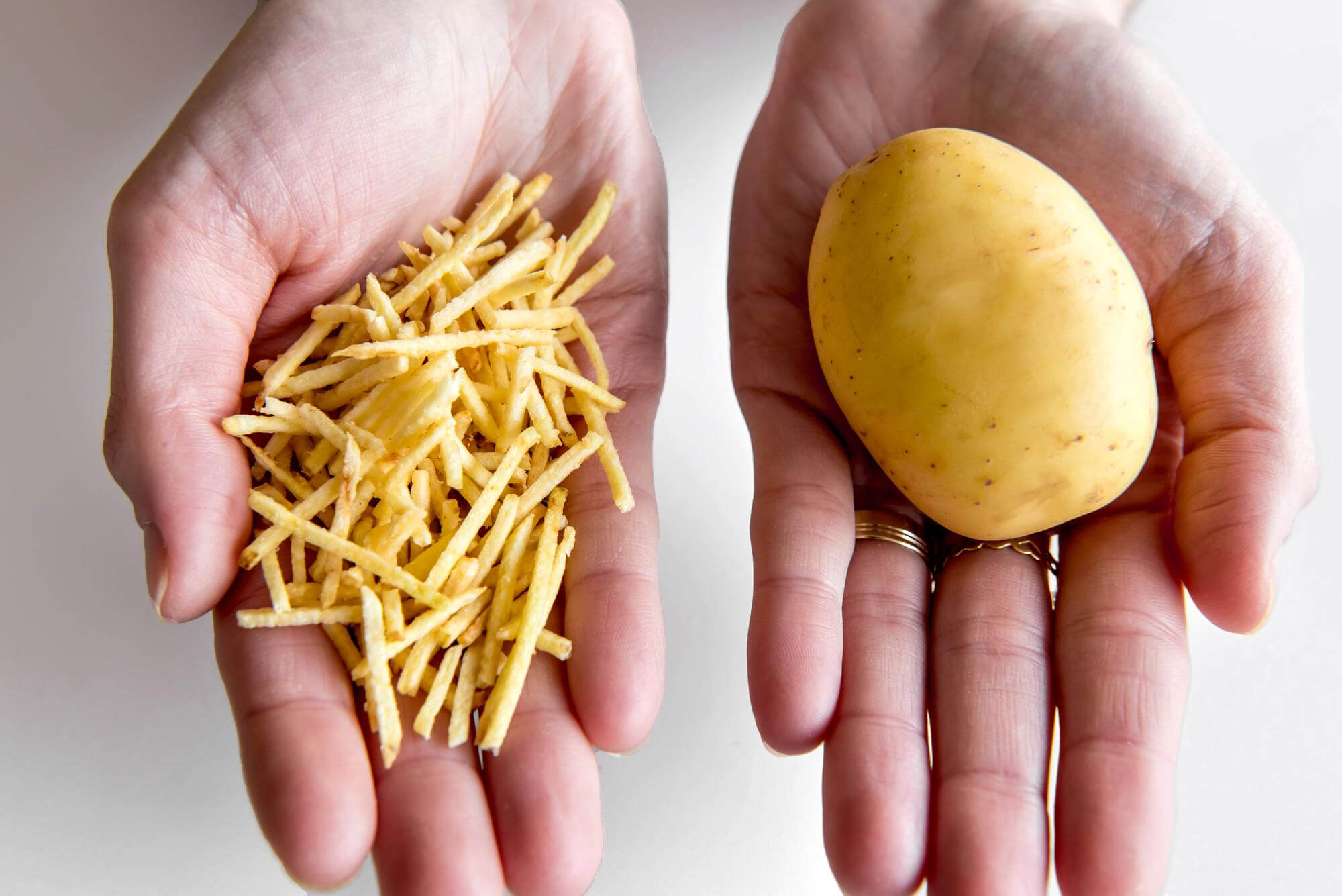 varieties of potato allergy