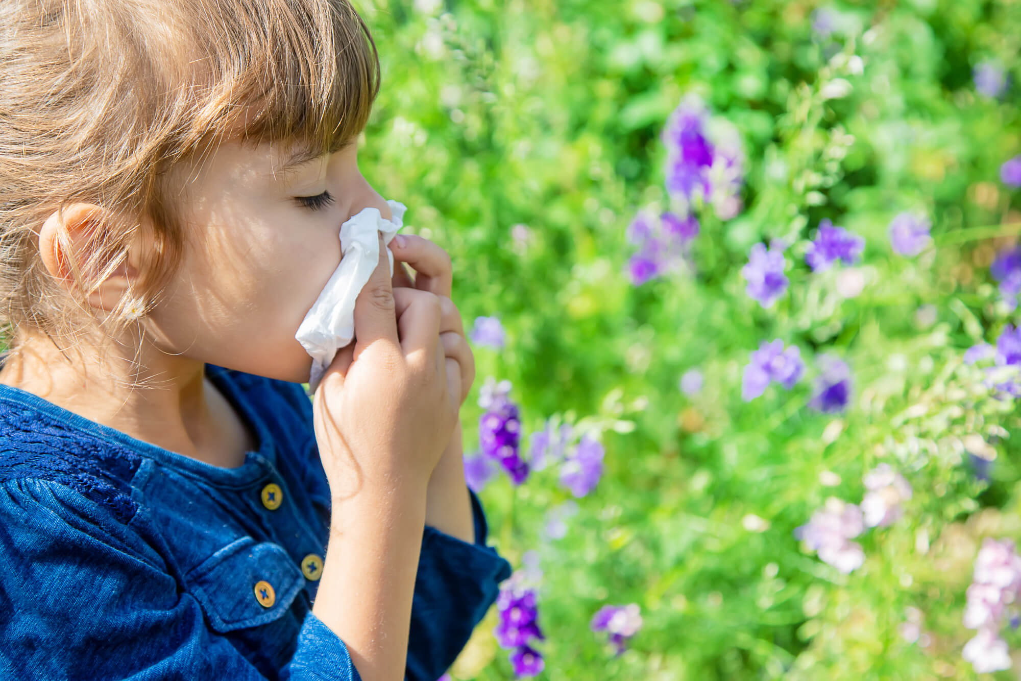 symptoms of allergic rhinitis in children