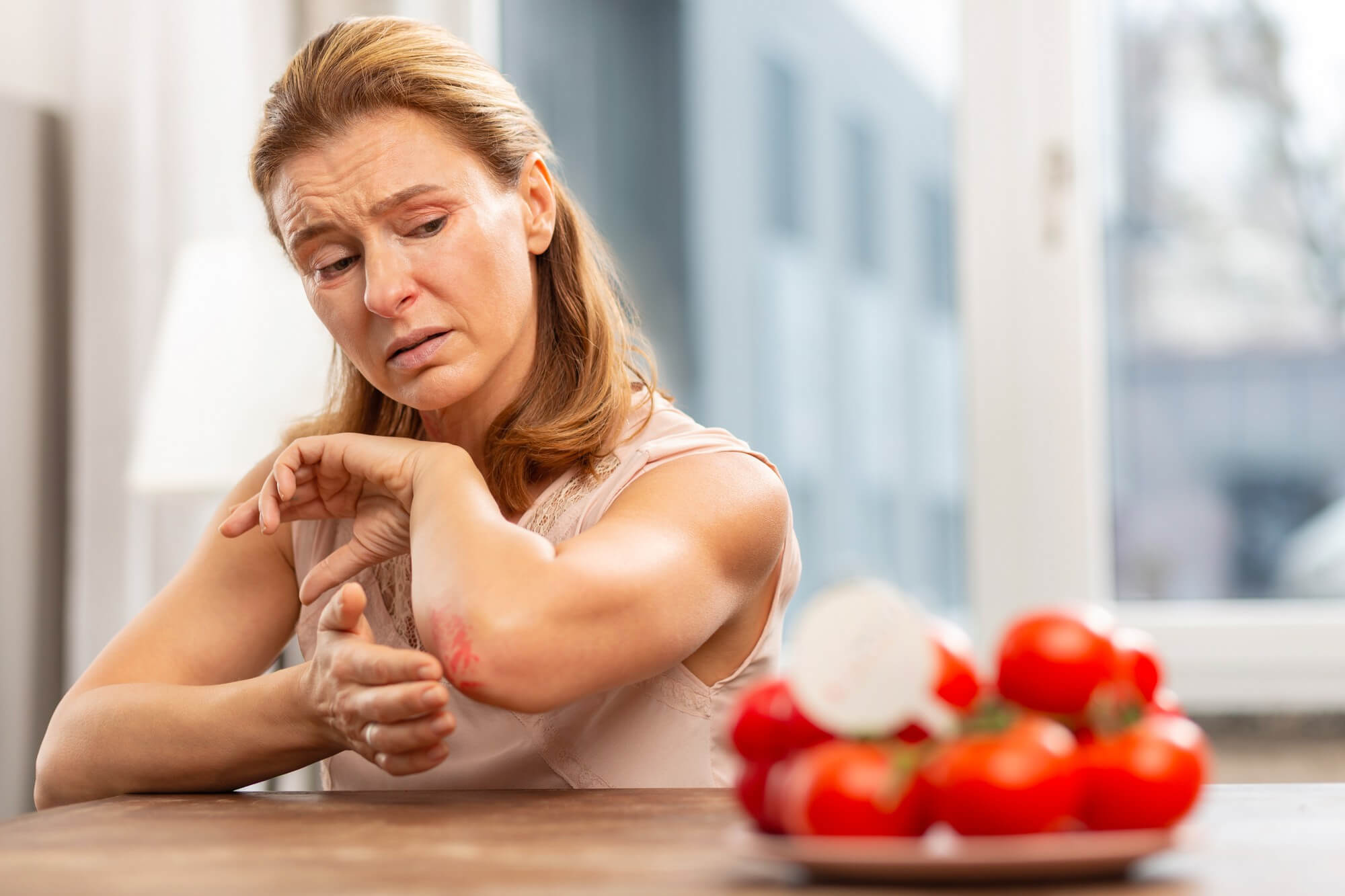 tomato allergy symptoms