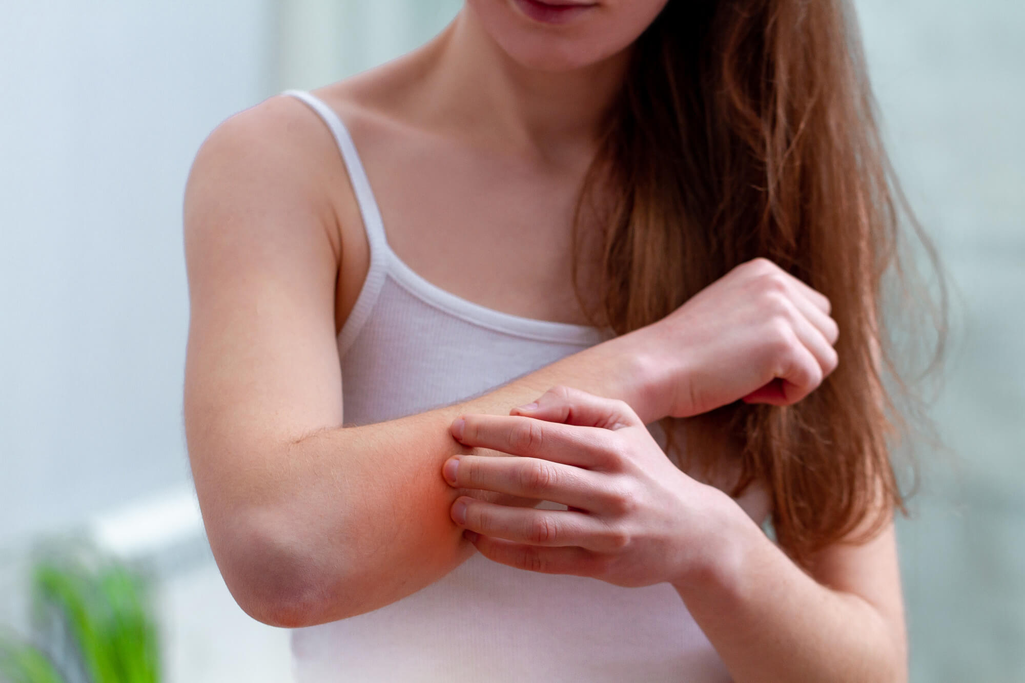 Prevention of allergic dermatitis