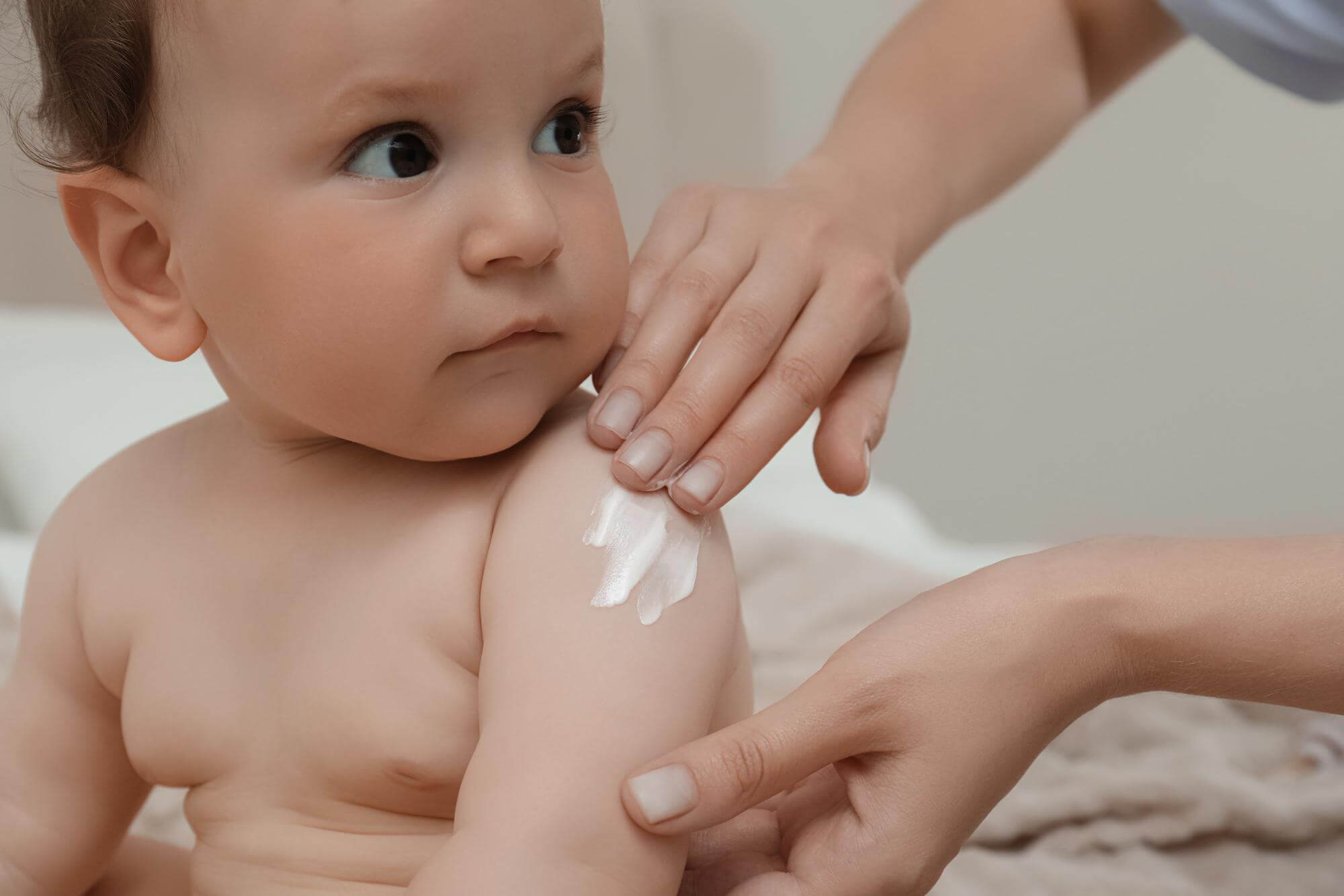 treatment of eczema in a child