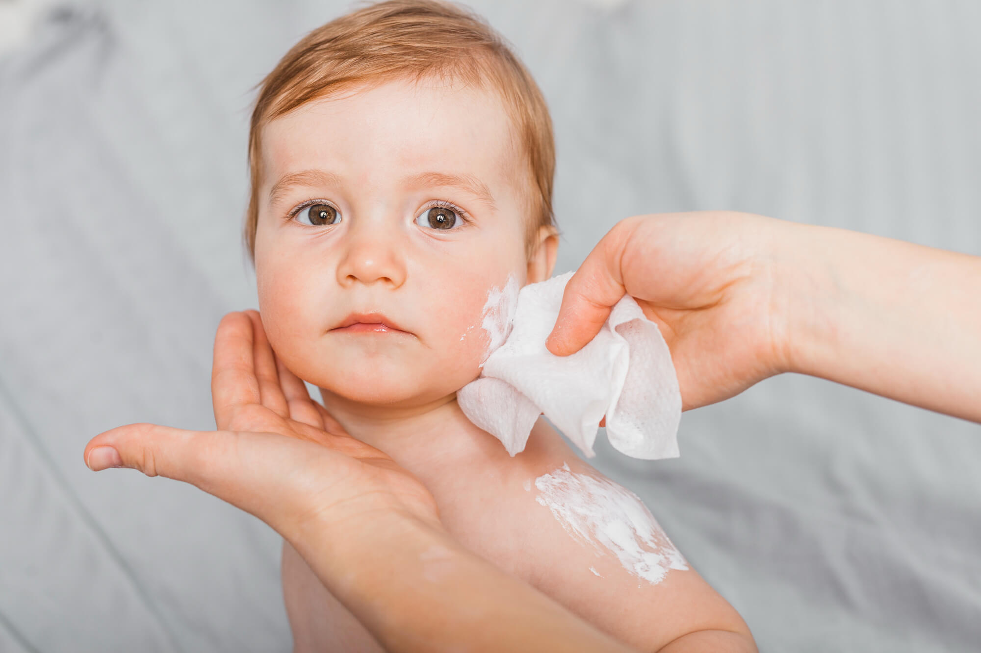 top allergy ointments for children