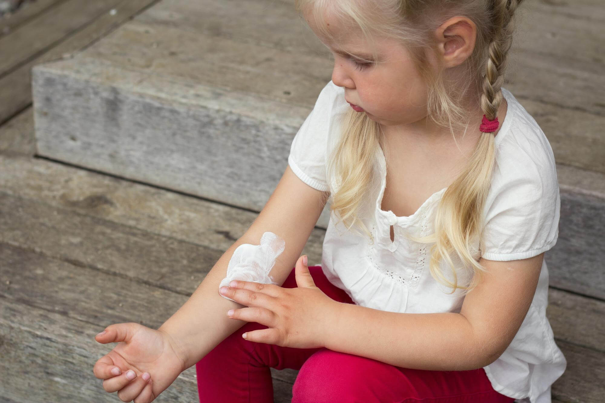 top dermatitis ointments for children