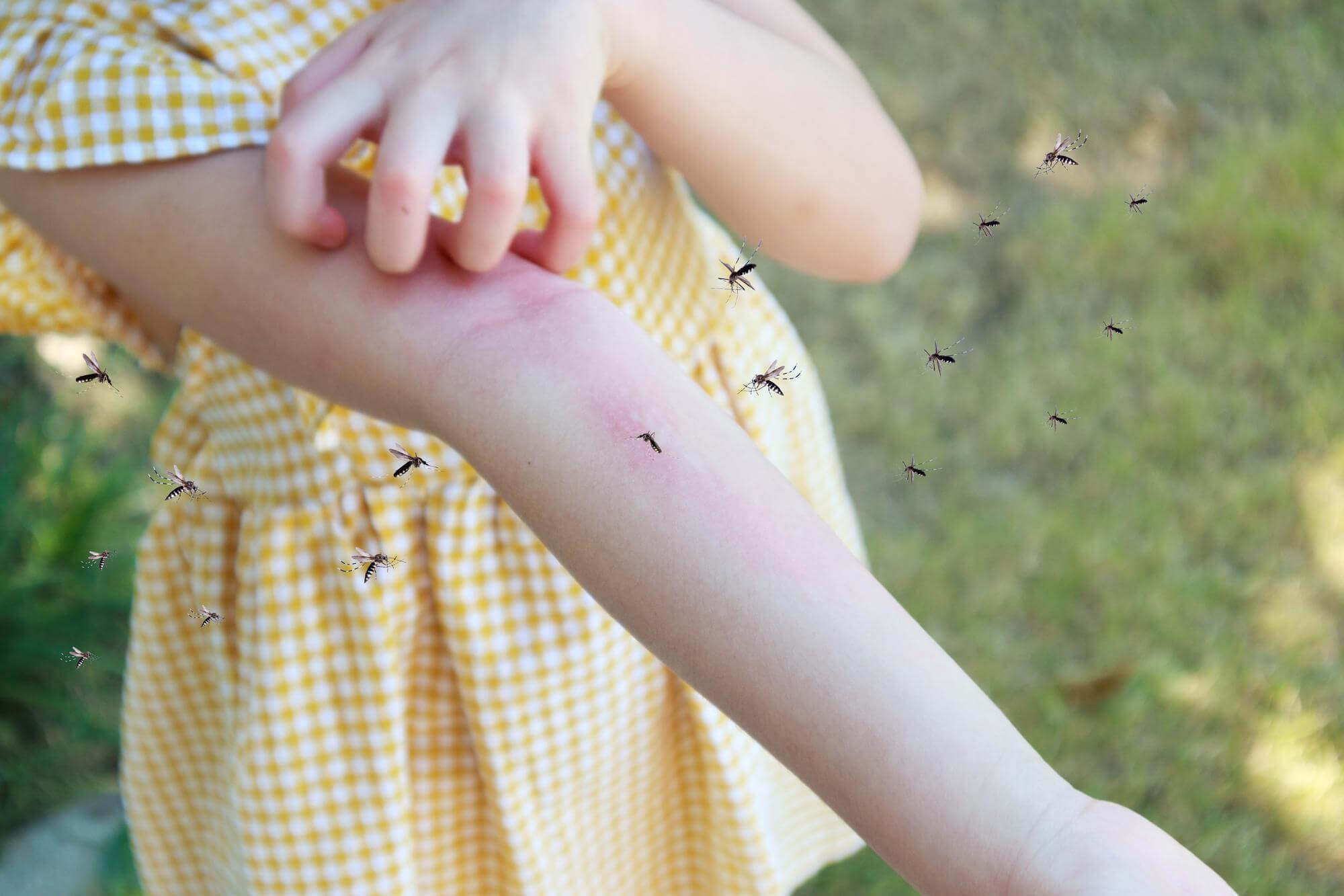 Causes of urticaria in children