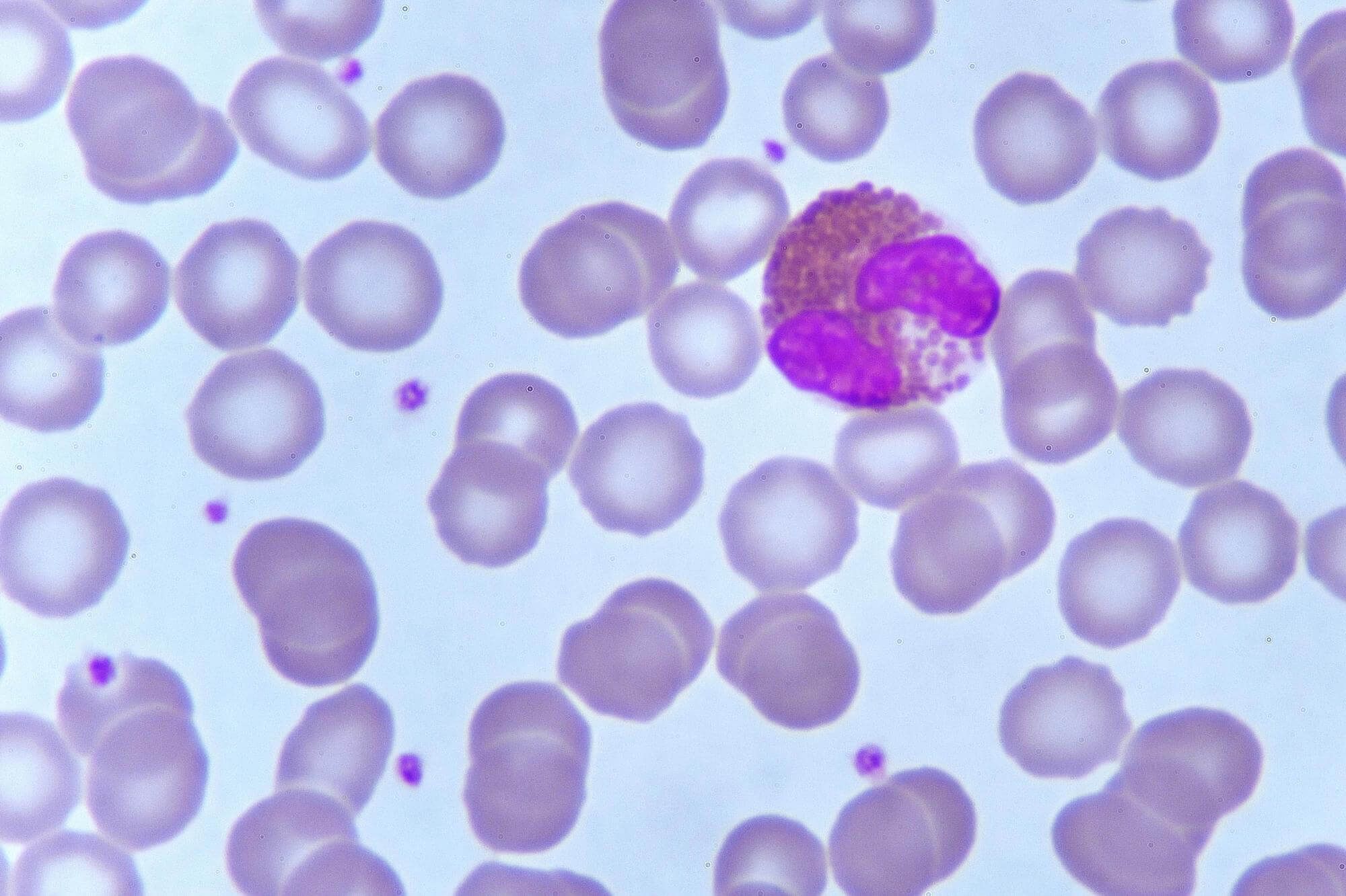 eosinophils