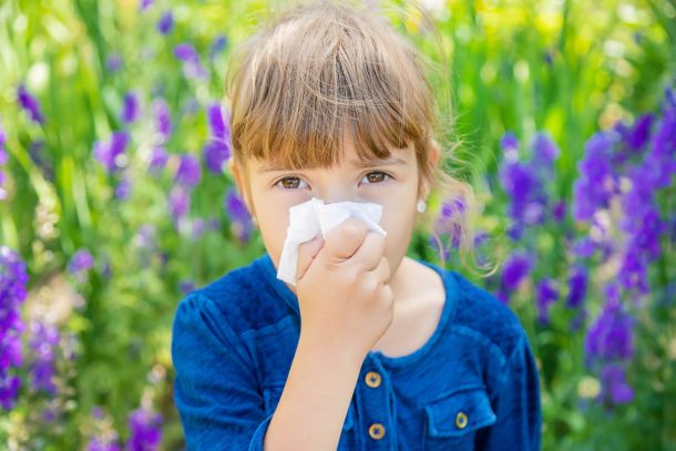 allergic rhinitis in children